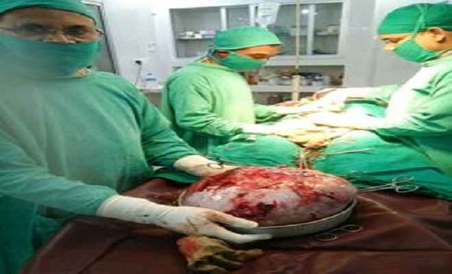 महिला के पेट से निकाला गया 12 किलो का ट्यूमर