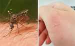 कैमिकल दवाइयां करेंगी सेहत खराब, इन घरेलू चीजों से मच्छरों को रखें दूर