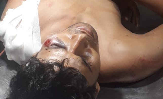 मोतिहारी के ढाका में तजिया के दौरान दो गुटों में हिंसक झड़प, भारी संख्या में पुलिस बल तैनात, एक दर्जन घायल