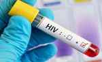 पाकिस्तान: एचआईवी के 400 पीड़ित सामने आए, संक्रमित सुई से वायरस फैलने का शक