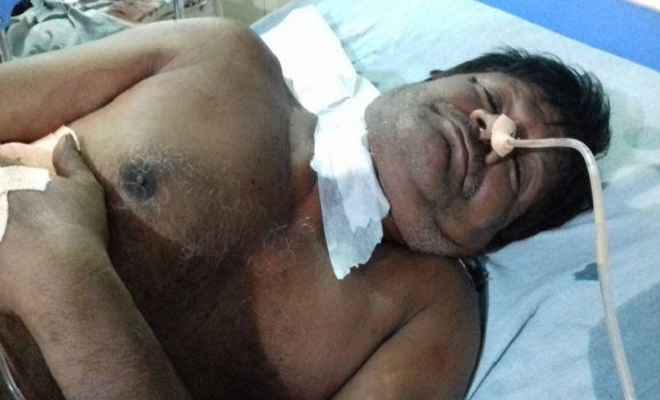 मुजफ्फरपुर में राजद के 2 नेताओं को अपराधियों ने मारी गोली, हालत गंभीर