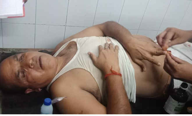 मोतिहारी के चकिया में जांच में गए दारोगा पर हमला, घायल, कई थानों की पुलिस के साथ मुक्त कराने पहुंचे डीएसपी