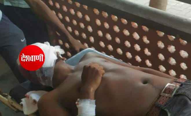रक्सौल रेलवे रनिंग रुम में अग्निशमन सिलिंडर विस्फोट से एक व्यक्ति घायल