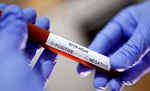Coronavirus in India: पिछले 24 घंटों में 81,484 नए मामले, अब तक 99,773 लोगों की मौत